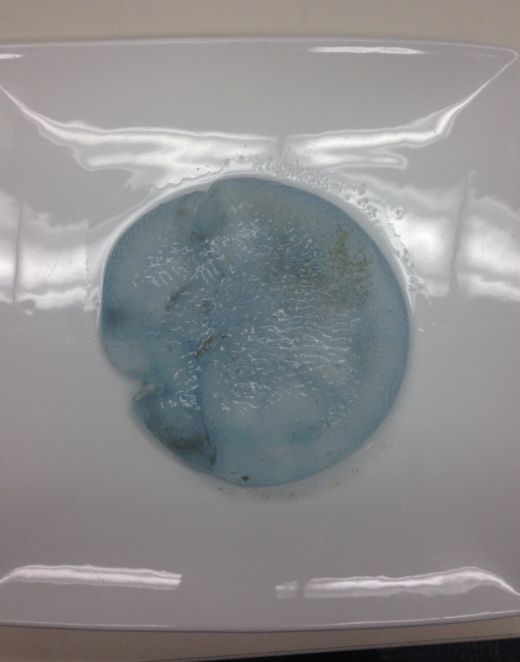 Безумный мир: Перепутал медузу с силиконом