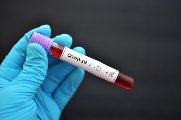 Коронавирус: COVID-19 уносит сейчас еженедельно около 50 тыс. жизней