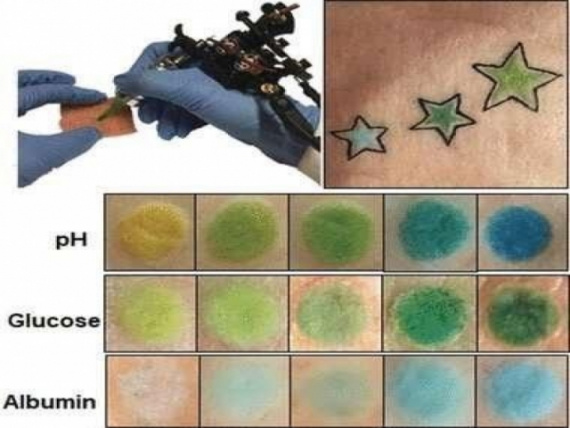 Интересное: Эти татуировки меняют цвет в зависимости от кислоты, глюкозы и альбумина в крови